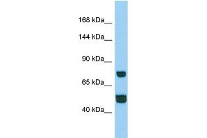 Western Blotting (WB) image for anti-Coiled-Coil Domain Containing 39 (CCDC39) (N-Term) antibody (ABIN2790737) (CCDC39 抗体  (N-Term))