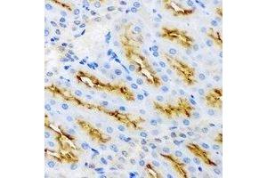 Immunohistochemistry (IHC) image for anti-Protein Kinase, AMP-Activated, beta 2 Non-Catalytic Subunit (PRKAB2) antibody (ABIN7308228) (PRKAB2 抗体)