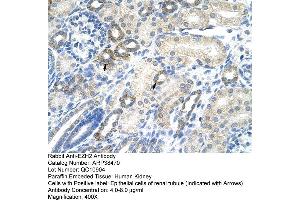 Human kidney (EZH2 抗体  (N-Term))