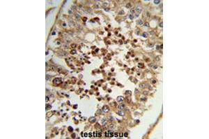 Formalin-fixed and paraffin-embedded human testis tissue reacted with TAC2N Antibody (N-term), which was peroxidase-conjugated to the secondary antibody, followed by DAB staining. (TC2N 抗体  (N-Term))