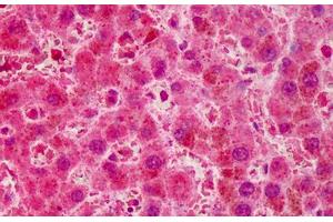 Human Liver: Formalin-Fixed, Paraffin-Embedded (FFPE) (RNF2 抗体  (AA 189-201))