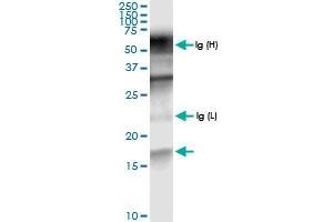 Immunoprecipitation of PTS transfected lysate using anti-PTS MaxPab rabbit polyclonal antibody and Protein A Magnetic Bead , and immunoblotted with PTS MaxPab rabbit polyclonal antibody (D01) . (PTS 抗体  (AA 1-145))