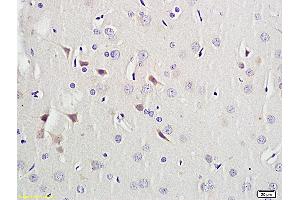 Formalin-fixed and paraffin embedded rat brain labeled with Anti-Activin A, Unconjugated (ABIN734273) followed by conjugation to the secondary antibody and DAB staining (ACVA 抗体  (AA 331-426))