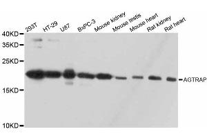 Western blot analysis of extracts of various cell lines, using AGTRAP antibody. (AGTRAP 抗体)