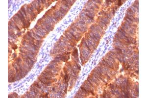 Immunohistochemistry (IHC) image for anti-Mucin 1 (MUC1) antibody (ABIN6940099)