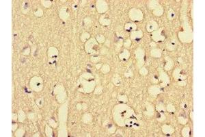 Immunohistochemistry of paraffin-embedded human brain tissue using ABIN7149360 at dilution of 1:100 (CKAP2L 抗体  (AA 246-413))