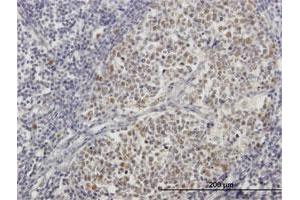 Immunohistochemistry (Formalin-fixed Paraffin-embedded Sections) (IHC (fp)) image for anti-Zinc Finger Protein 296 (ZNF296) (AA 1-475) antibody (ABIN949885)