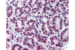 Immunohistochemistry (IHC) image for anti-Signal Transducer and Activator of Transcription 5A (STAT5A) (Tyr694) antibody (ABIN400812) (STAT5A 抗体  (Tyr694))