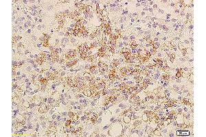 Formalin-fixed and paraffin embedded mouse transplant lymphoma labeled with Anti-Bcl-xL/BCL2L1/bcl-xs, Unconjugated (ABIN675129) at 1:800, followed by conjugation to the secondary antibody and DAB staining.