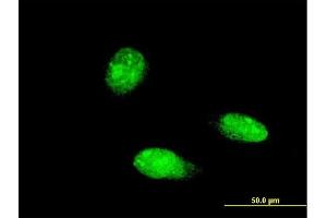 Immunofluorescence of monoclonal antibody to TRIM46 on HeLa cell. (TRIM46 抗体  (AA 451-560))