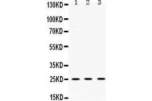 Western Blotting (WB) image for anti-Ubiquitin Carboxyl-terminal Esterase L1 (Ubiquitin Thiolesterase) (UCHL1) (AA 120-153), (C-Term) antibody (ABIN3042339) (UCHL1 抗体  (C-Term))