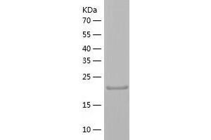 CHMP3 Protein (AA 1-222) (His tag)