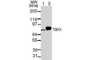 TBK1 NAK Western Blot. (TBK1 抗体)