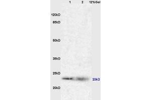 Lane 1: mouse liver lysates Lane 2: myeloma cell sp-20 lysates probed with Anti RAB7 Polyclonal Antibody, Unconjugated (ABIN720191) at 1:200 in 4 °C. (RAB7A 抗体  (AA 101-207))
