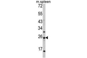 Western blot analysis of FKBP11 Antibody (C-term) in mouse spleen tissue lysates (35ug/lane). (FKBP11 抗体  (C-Term))