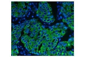 IF analysis of Cytokeratin 8 using anti-Cytokeratin 8 antibody (ABIN6719478). (KRT8 抗体  (AA 107-325))