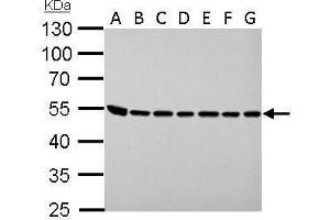 Western Blotting (WB) image for anti-Argininosuccinate Lyase (ASL) antibody (ABIN2856924)