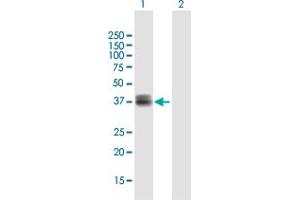 Western Blot analysis of WISP3 expression in transfected 293T cell line by WISP3 MaxPab polyclonal antibody. (WISP3 抗体  (AA 1-372))