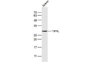 Mouse spleen lysates probed with TIPRL Polyclonal Antibody, Unconjugated  at 1:300 dilution and 4˚C overnight incubation. (TIPRL 抗体  (AA 51-150))