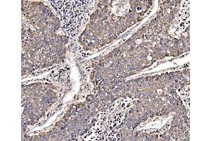 IHC analysis of GGA3 using anti-GGA3 antibody (ABIN7602337).