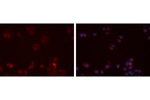 ABIN6273472 staining Hela cells by IF/ICC. (CX3CR1 抗体  (N-Term))