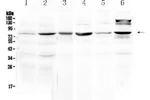 Western blot analysis of HSD17B4 using anti- HSD17B4 antibody . (HSD17B4 抗体  (AA 510-736))