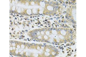 Immunohistochemistry of paraffin-embedded Human colon using SERPINA6 Polyclonal Antibody at dilution of 1:100 (40x lens). (SERPINA6 抗体)