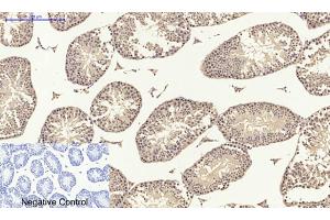 Immunohistochemical analysis of paraffin-embedded Mouse testis tissue. (SMAD2 抗体)