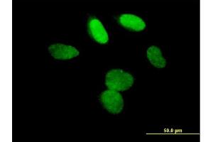 Immunofluorescence of purified MaxPab antibody to L3MBTL on HeLa cell. (L3MBTL1 抗体  (AA 1-772))