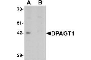 Western blot analysis of DPAGT1 in mouse kidney tissue lysate with DPAGT1 antibody at 1 μg/mL in (A) the absence and (B) the presence of blocking peptide. (DPAGT1 抗体  (N-Term))