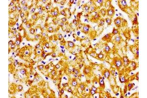 Immunohistochemistry of paraffin-embedded human liver tissue using ABIN7151799 at dilution of 1:100 (PECI/ECI2 抗体  (AA 119-219))