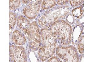 ABIN6266902 at 1/100 staining human kidney tissue sections by IHC-P. (DGKH 抗体  (Internal Region))