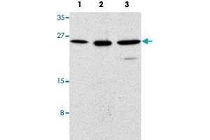 Western blot analysis of human (1), mouse (2), and rat (3) kidney cells with TICAM2 polyclonal antibody  at 1 ug/mL dilution. (TICAM2 抗体  (C-Term))