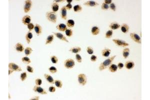 ICC testing of FFPE human SMMC-7721 cells with PRDX3 antibody. (Peroxiredoxin 3 抗体  (AA 110-256))