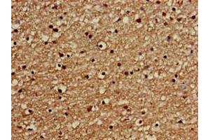 Immunohistochemistry of paraffin-embedded human brain tissue using ABIN7154324 at dilution of 1:100 (Golgin A3 抗体  (AA 217-405))
