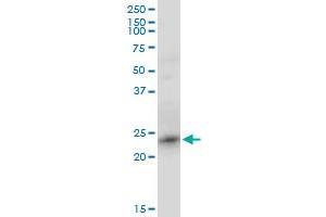 RRAS2 monoclonal antibody (M01), clone 2D3-4B8. (RRAS2 抗体  (AA 1-204))