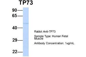 Host:  Rabbit  Target Name:  TP73  Sample Type:  Human Fetal Muscle  Antibody Dilution:  1. (Tumor Protein p73 抗体  (N-Term))