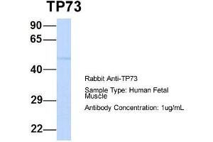 Host:  Rabbit  Target Name:  TP73  Sample Type:  Human Fetal Muscle  Antibody Dilution:  1.