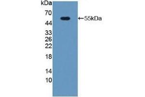 Detection of Recombinant PGP, Mouse using Polyclonal Antibody to Phosphoglycolate Phosphatase (PGP)