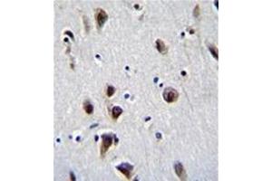 Formalin fixed, paraffin embedded human brain tissue stained with MeCP2 Antibody (N-term) followed by peroxidase conjugation of the secondary antibody and DAB staining. (MECP2 抗体  (N-Term))
