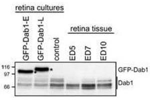 Western Blotting (WB) image for anti-Disabled Homolog 1 (Drosophila) (DAB1) (AA 400-555) antibody (ABIN6657863)