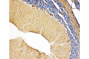 IHC-P: NME2 antibody testing of rat cerebellum tissue (NME2 抗体  (AA 137-152))