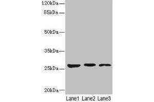 Western blot All lanes: KLK6 antibody at 5 μg/mL Lane 1: Mouse liver tissue Lane 2: Mouse brain tissue Lane 3: A375 whole cell lysate Secondary Goat polyclonal to rabbit IgG at 1/10000 dilution Predicted band size: 27, 16, 5 kDa Observed band size: 27 kDa (Kallikrein 6 抗体  (AA 22-244))