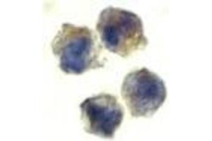 Immunocytochemistry of IL-22 receptor in HepG2 cells with AP30417PU-N IL-22 receptor antibody at 10 μg/ml. (IL22 Receptor alpha 1 抗体  (N-Term))