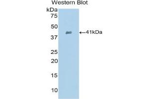 Western blot analysis of the recombinant protein. (CCL21 抗体  (AA 5-130))