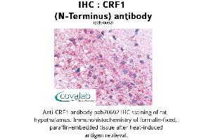 Image no. 2 for anti-Corticotropin Releasing Hormone Receptor 1 (CRHR1) (Extracellular Domain), (N-Term) antibody (ABIN1733304)