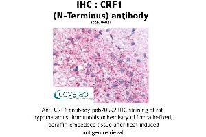 Image no. 2 for anti-Corticotropin Releasing Hormone Receptor 1 (CRHR1) (Extracellular Domain), (N-Term) antibody (ABIN1733304) (CRHR1 抗体  (Extracellular Domain, N-Term))