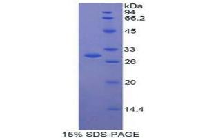 SDS-PAGE analysis of Human CNTFR Protein. (CNTF Receptor alpha 蛋白)