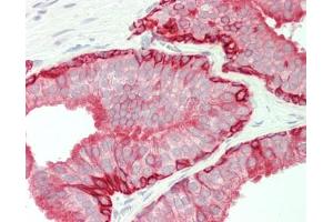 Human Prostate: Formalin-Fixed, Paraffin-Embedded (FFPE) (Cytokeratin 5 抗体  (AA 1-273))