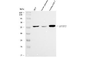 Western blot analysis of Nesprin 2/SYNE2 using anti-Nesprin 2/SYNE2 antibody (ABIN7601532). (SYNE2 抗体  (AA 3765-5590))